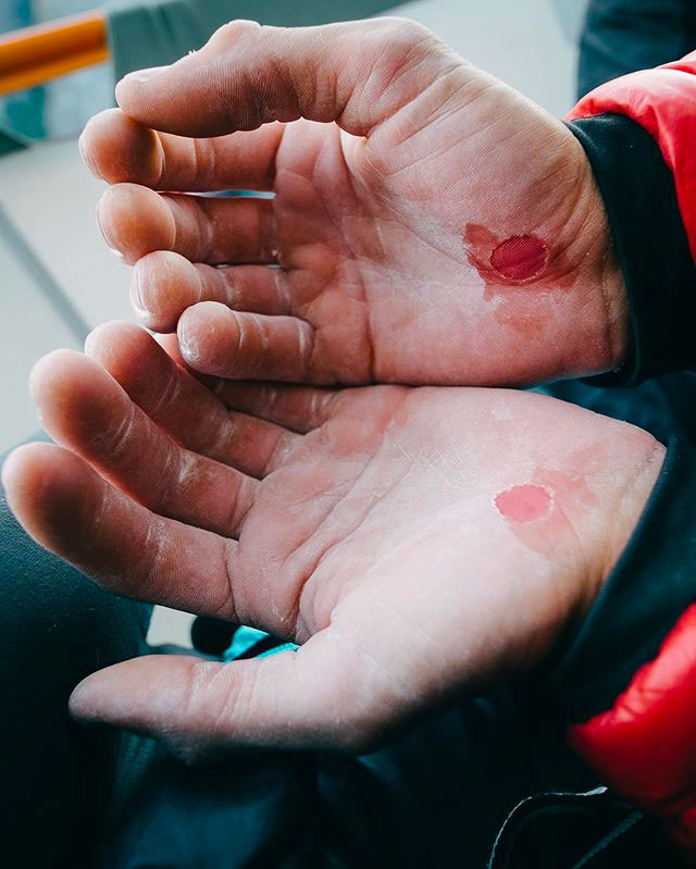 Barbara Zangerl - Les mains de Jacopo Larcher après une tentative sur le Stemming Corner Pitch sur le mur Pre-Muir jusqu'à El Capitan à Yosemite